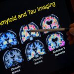 Investigación en laboratorio enfocada en el estudio de la enfermedad de Alzheimer y la formación de fibrillas tau.